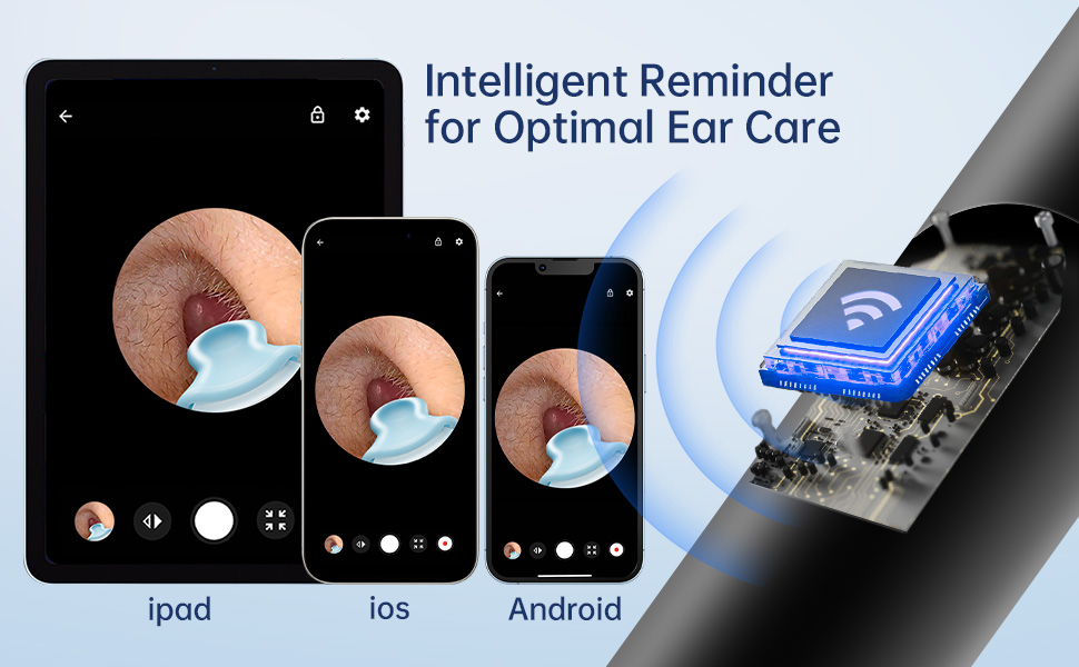 Intelligent Reminder for Optimal Ear care